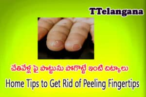 చేతివేళ్ల పై పొట్టును పోగొట్టే ఇంటి చిట్కాలు,Home Tips to Get Rid of Peeling Fingertips