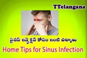సైనస్ ఇన్ఫెక్షన్ కోసం ఇంటి చిట్కాలు,Home Tips for Sinus Infection